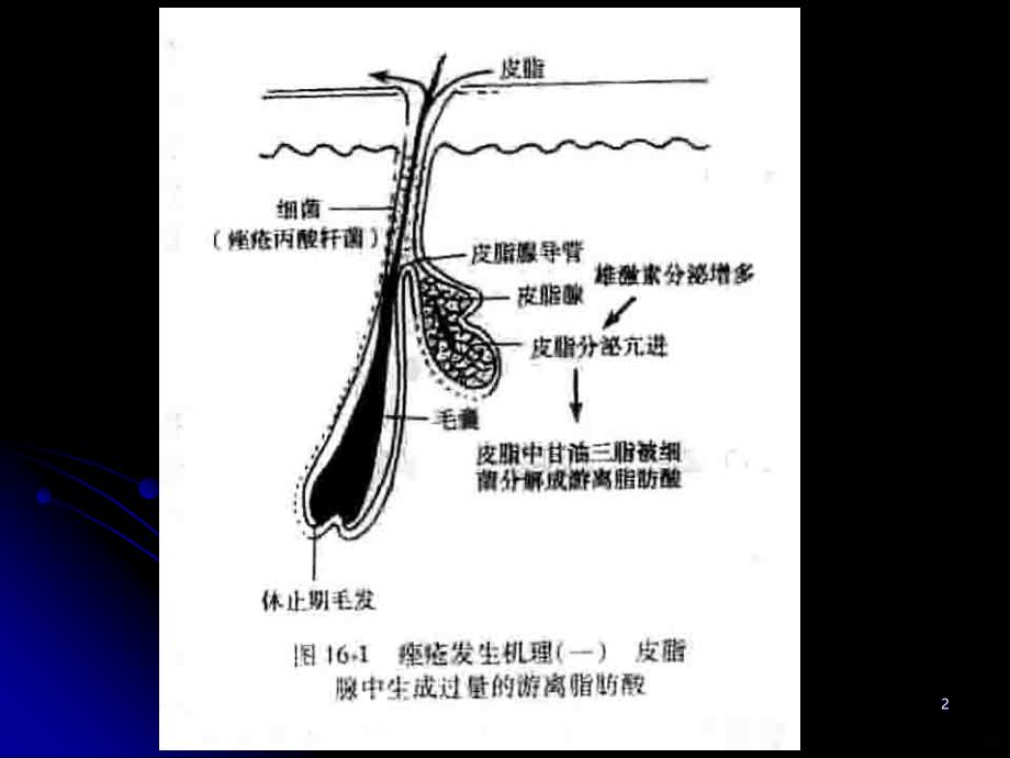 治疗痤疮药PPT课件.ppt_第2页