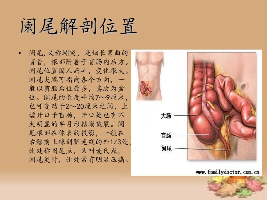 阑尾切除术的手术配合PPT课件.ppt_第2页