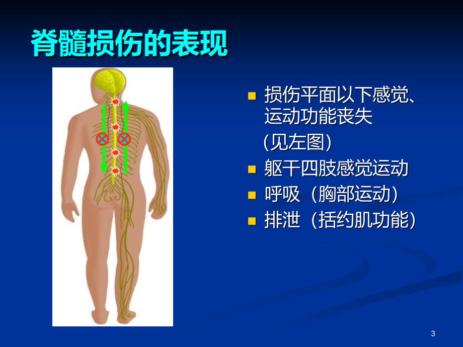 脊柱脊髓损伤的临PPT课件.ppt_第3页