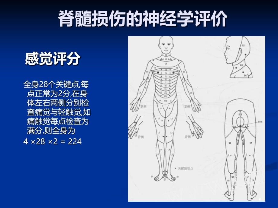 脊柱脊髓损伤的临PPT课件.ppt_第5页