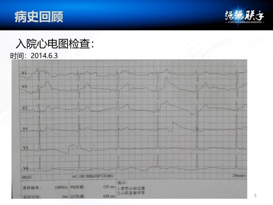 波立维病例-NSTEMIPPT课件.ppt_第5页