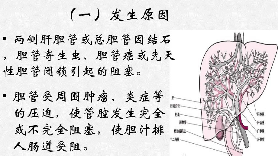 肝后性黄疸PPT课件.ppt_第4页