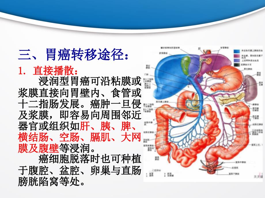 恐怖的胃癌转移_第4页