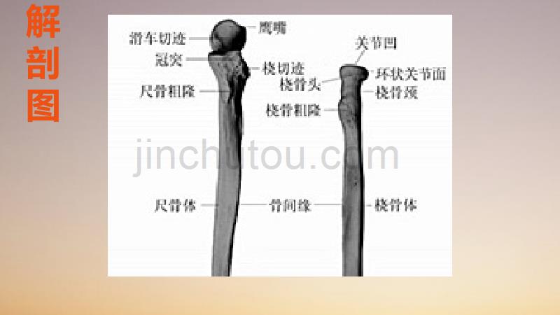 尺桡骨骨折护理查房精品PPT课件.ppt_第4页