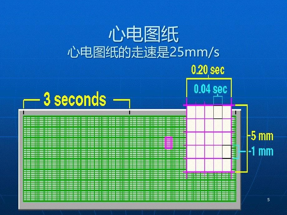 正常范围心电图PPT课件.ppt_第5页