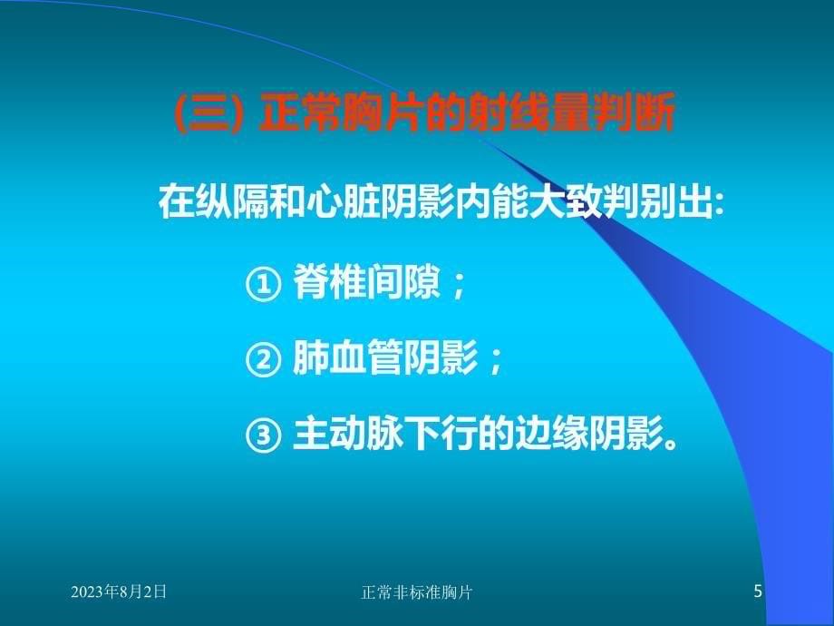 小儿胸片的特点PPT课件.ppt_第5页