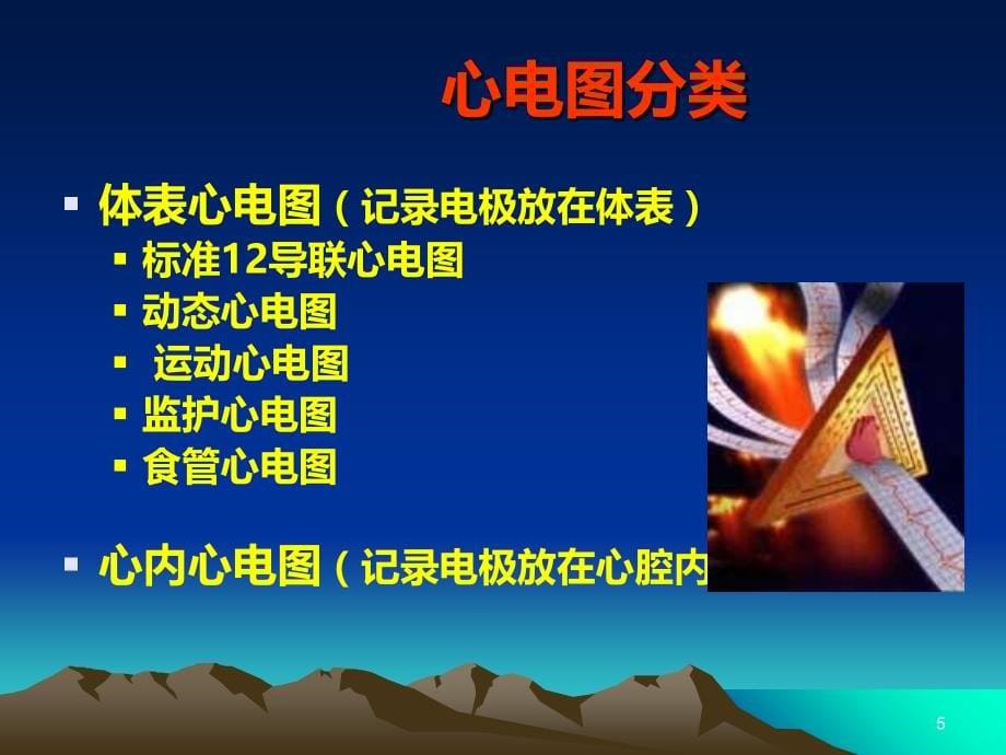 心电图诊断学上PPT课件.ppt_第5页