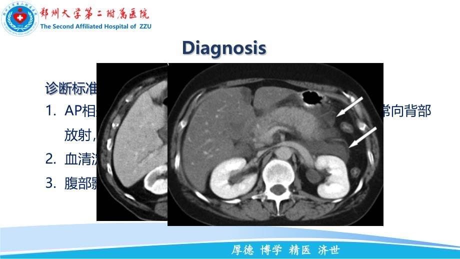 重症急性胰腺炎的综合治疗PPT课件.ppt_第5页