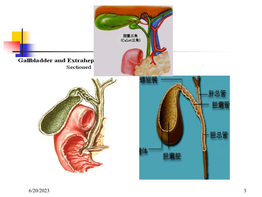 三、胆石症PPT课件.ppt_第3页