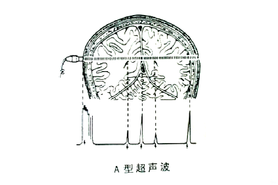 超声医学历史、现状及进展PPT课件.ppt_第3页