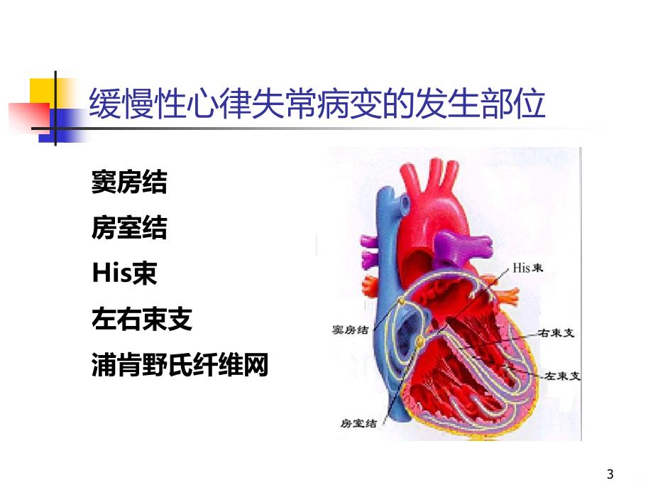 缓慢性心律失常的诊断和治疗PPT课件.ppt_第3页