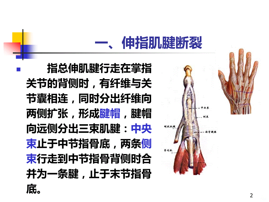 指伸屈肌腱断裂PPT课件.ppt_第2页