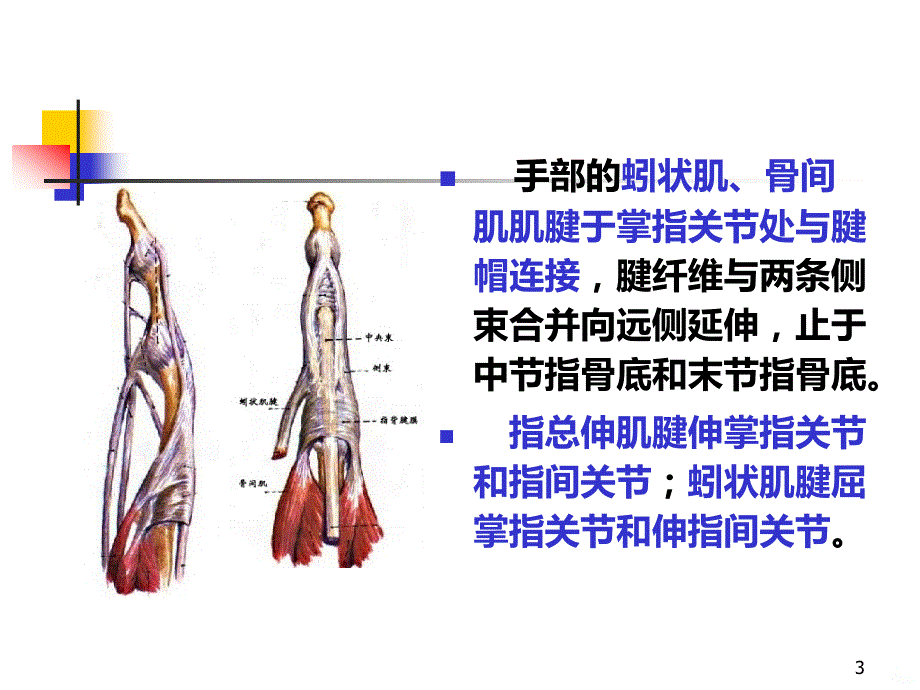 指伸屈肌腱断裂PPT课件.ppt_第3页