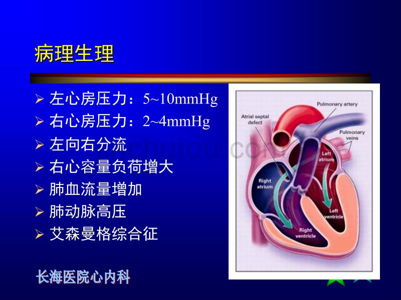 房间隔缺损介入治疗ppt课件.ppt_第3页