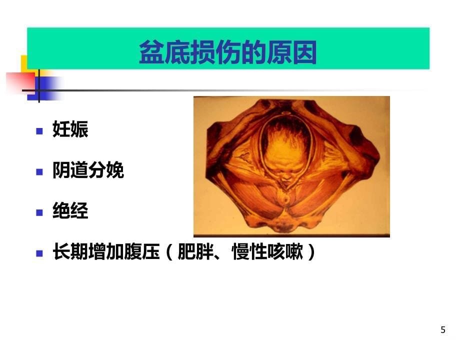 盆腔结构功能MRI研究PPT课件.ppt_第5页