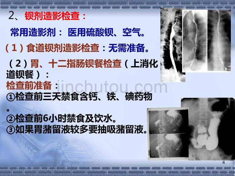 消化道的常用检查PPT课件.ppt_第4页