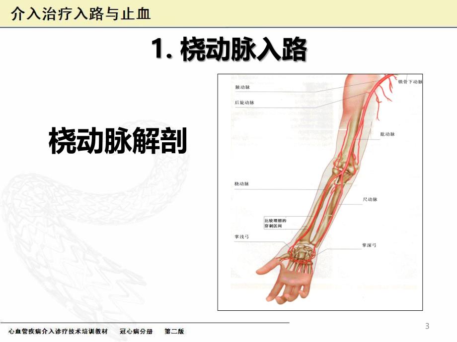 介入治疗穿刺技术PPT课件.ppt_第3页