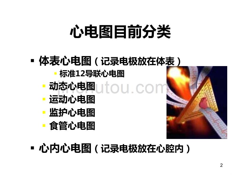 名师推荐临床心电图分析PPT课件.ppt_第2页