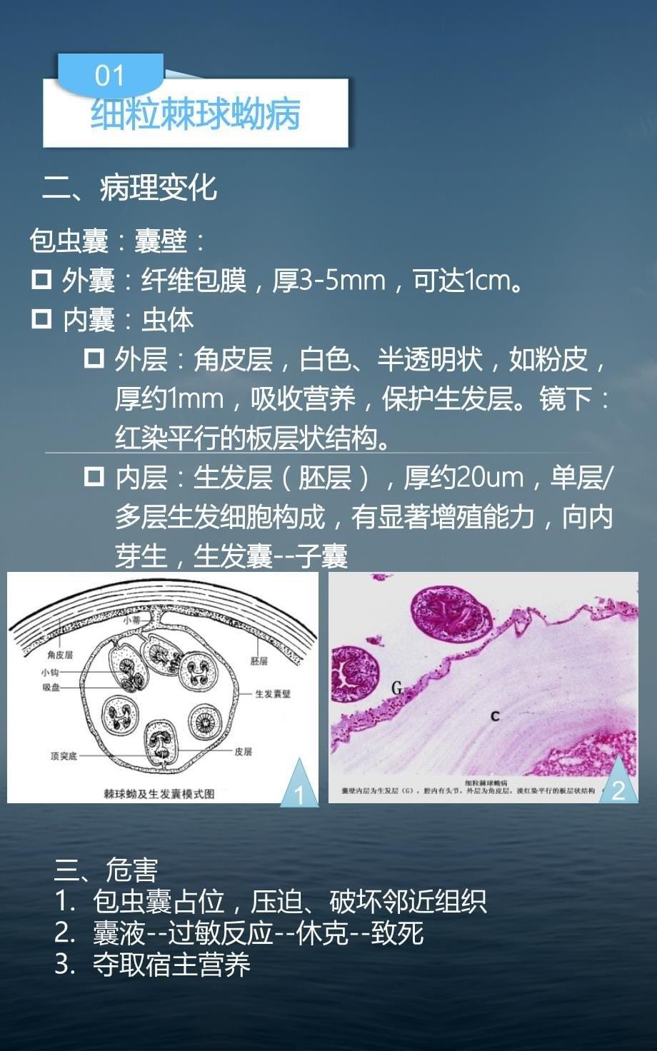 寄生虫-棘球蚴病PPT课件.ppt_第5页