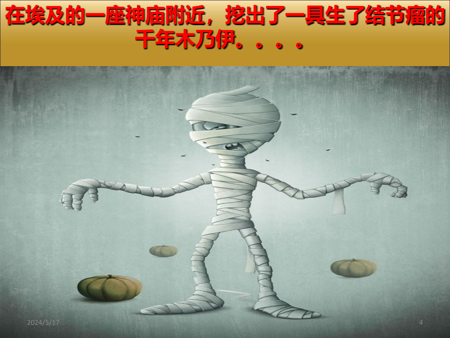 帝王病的治疗PPT课件.ppt_第4页