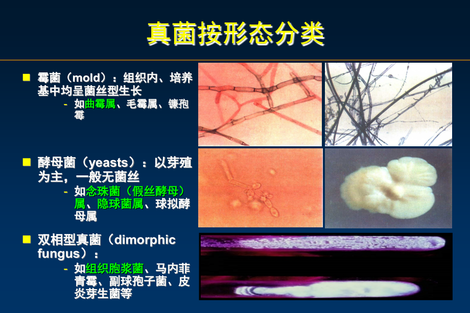 肺部真菌病PPT专业课件.ppt_第2页