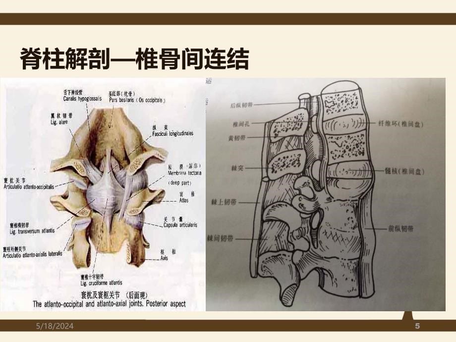 脊柱侧弯矫形术手术配合方法PPT课件.ppt_第5页