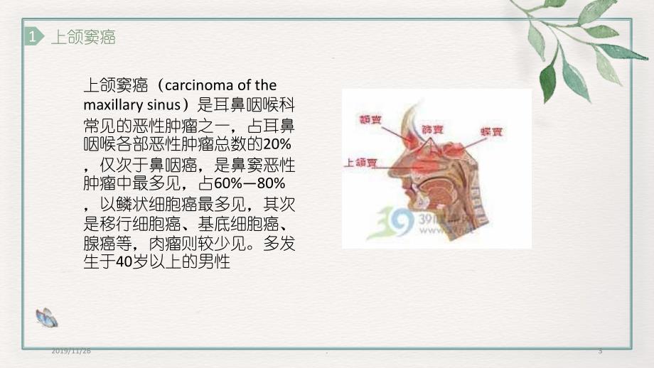 上颌窦癌PPT课件.ppt_第3页