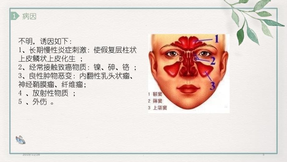 上颌窦癌PPT课件.ppt_第5页