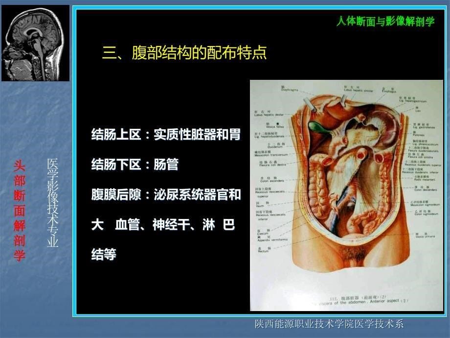 腹部断层解剖PPT课件.ppt_第5页