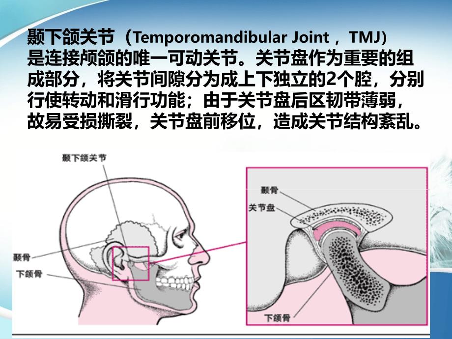 颞颌关节手术简介PPT课件.ppt_第2页