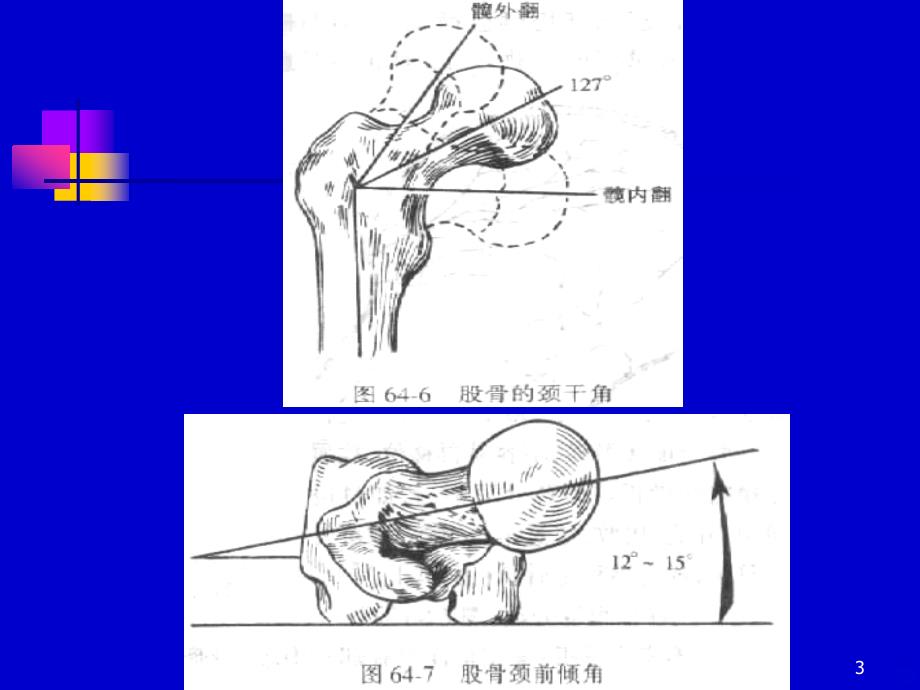 下肢骨折牵引图PPT课件.ppt_第3页
