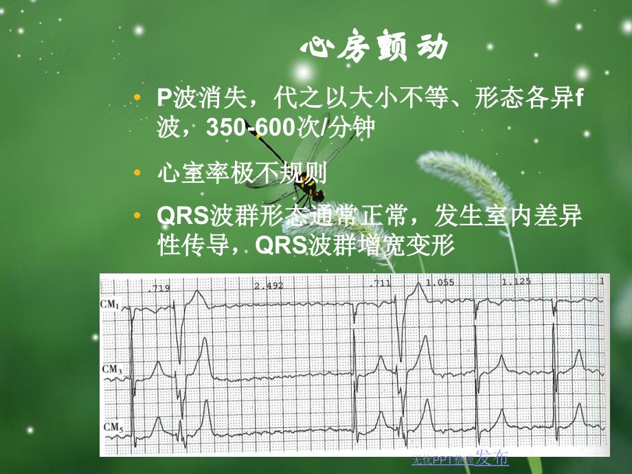 房扑与房颤心电图PPT专业课件.ppt_第3页