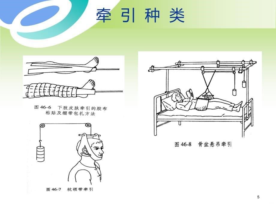 骨科牵引术的护理PPT课件.ppt_第5页