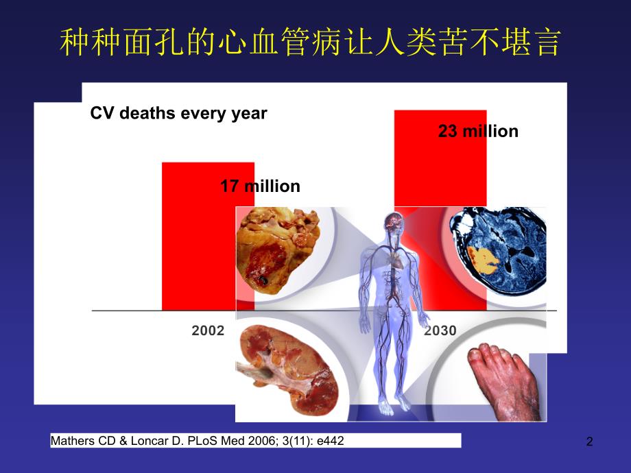 心血管病传统及新危险因素评价ppt课件.ppt_第2页