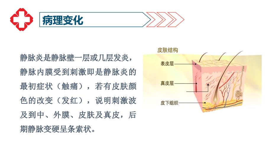 静脉炎的护理要点PPT课件.ppt_第4页