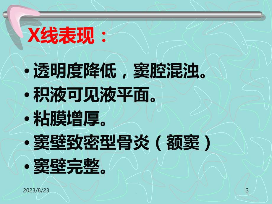 精选五官系统x线诊断资料PPT课件.ppt_第3页