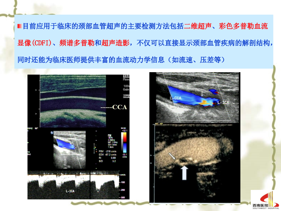 颈部血管超声检查-201X.ppt_第3页
