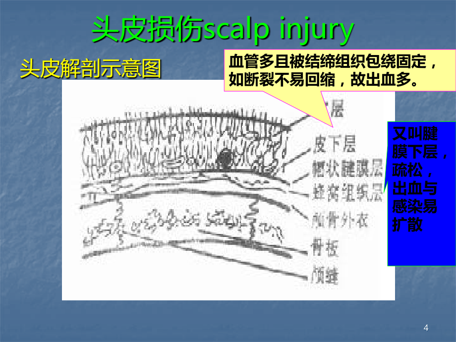 颅脑损伤-诊治PPT课件.ppt_第4页