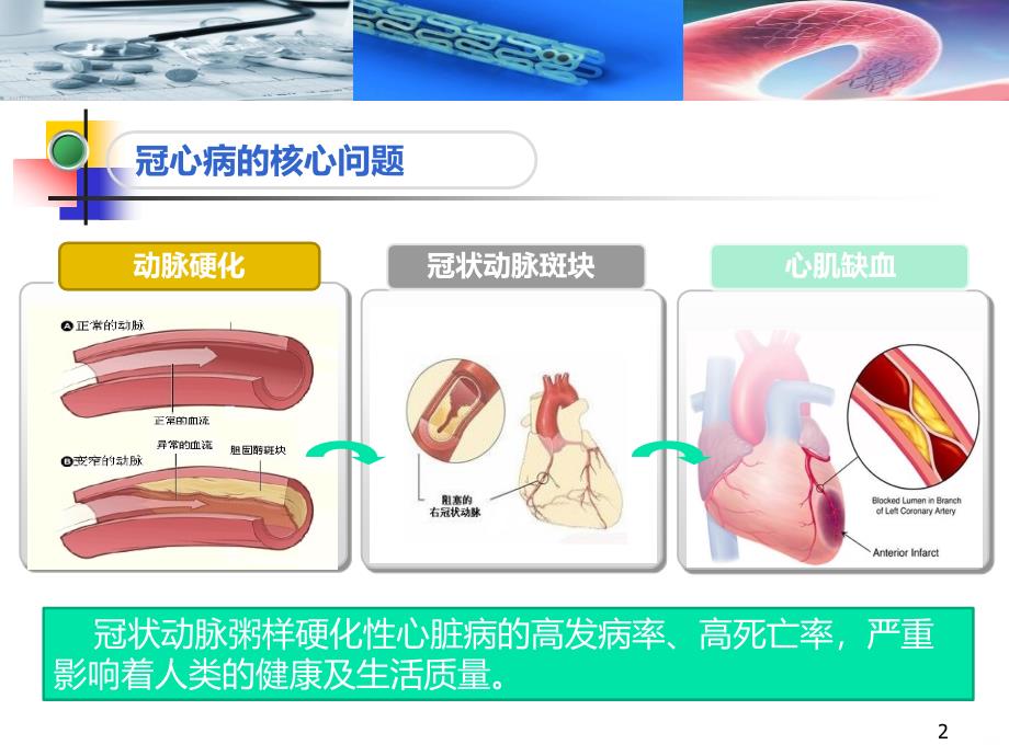 心血管神经官能症PPT课件.ppt_第2页