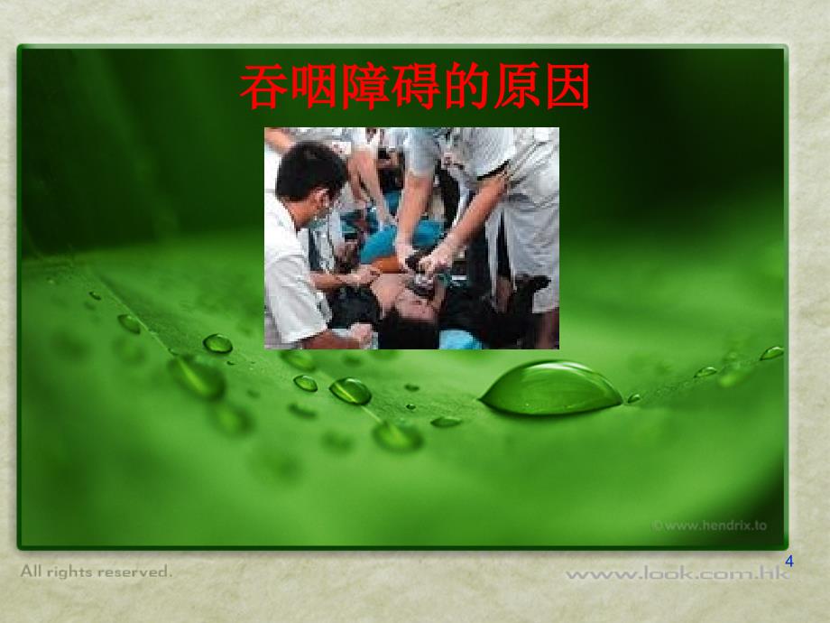 吞咽功能障碍的康复_护理PPT课件.ppt_第4页