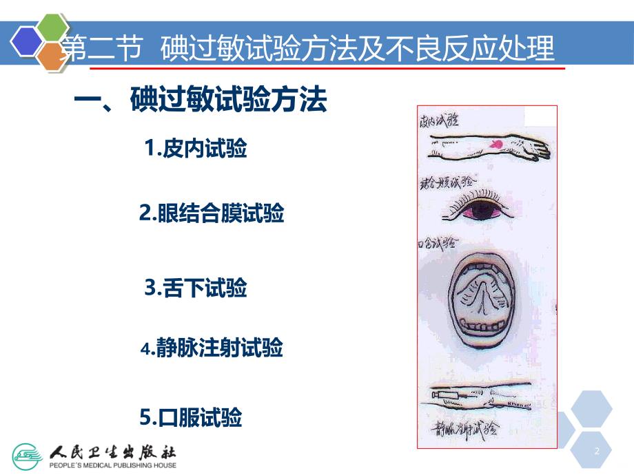 碘过敏试验及不良反应处理措施PPT课件.ppt_第2页