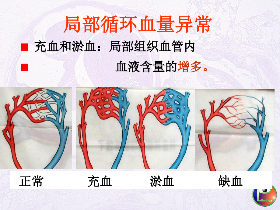 局循障碍-完整版本.ppt_第4页