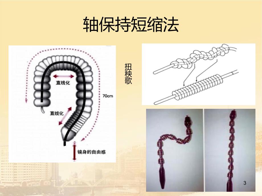 进修心得：肠镜诊疗应知的那些事儿PPT课件.ppt_第3页