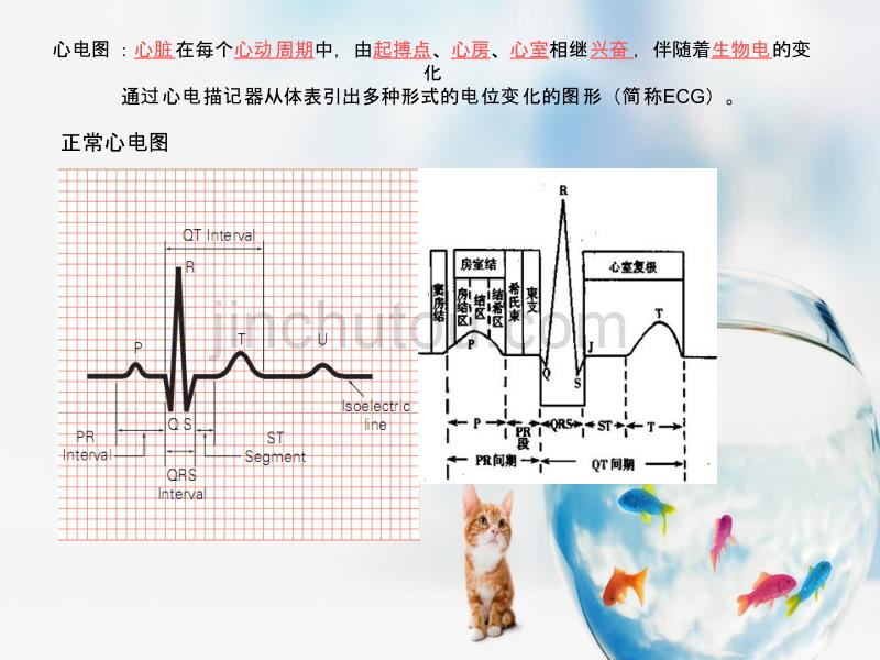 常见危机心电图及处理_第2页