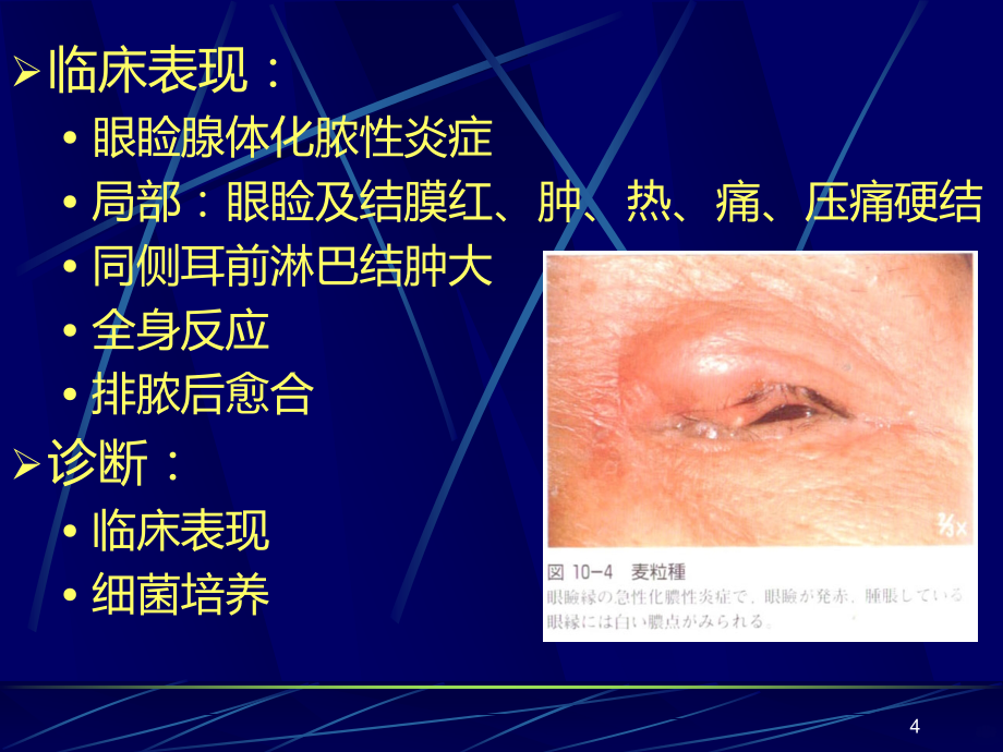 泪腺PPT课件.ppt_第4页