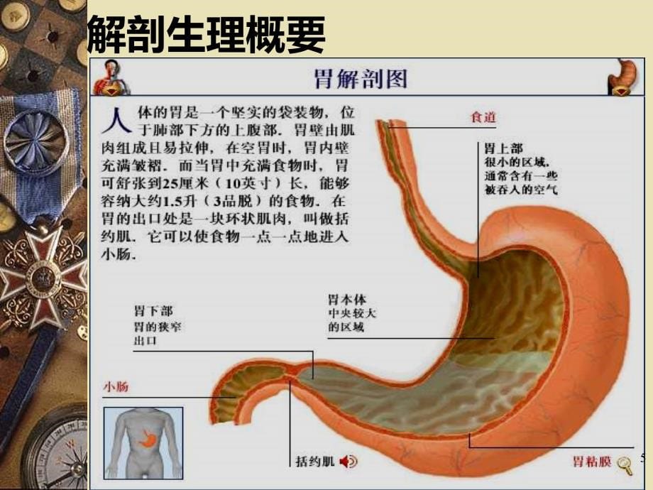 护理学-胃十二指肠疾病病人的护理PPT课件.ppt_第5页