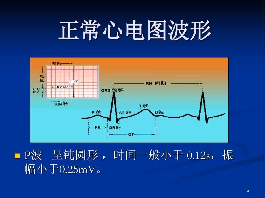 正常心电图波形特点PPT课件.ppt_第5页