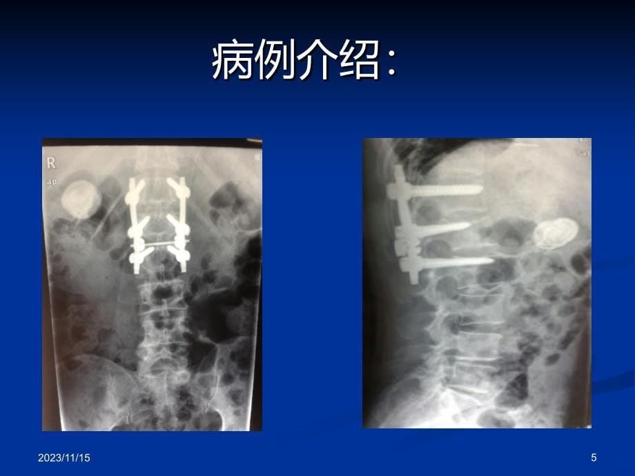 护理教学查房杨艳娥毛海英描述PPT课件.ppt_第5页