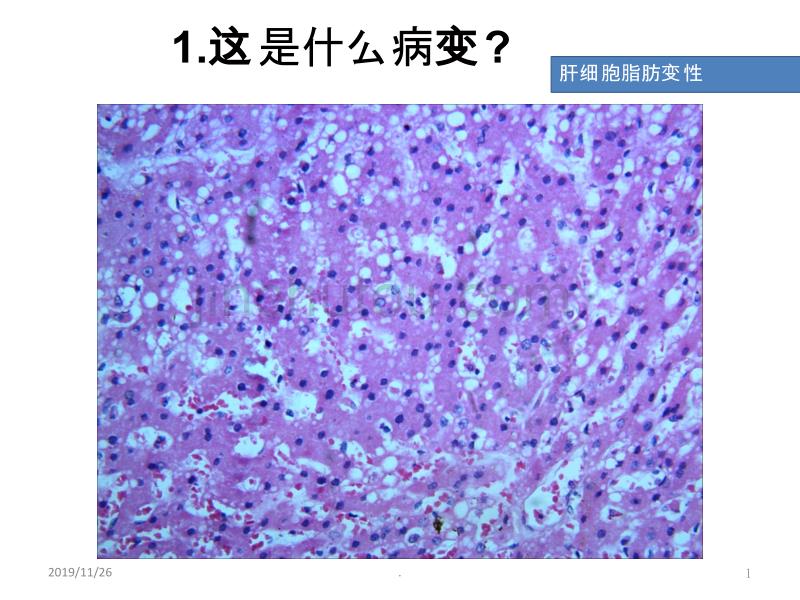 病理切片考试复习PPT课件.ppt_第1页