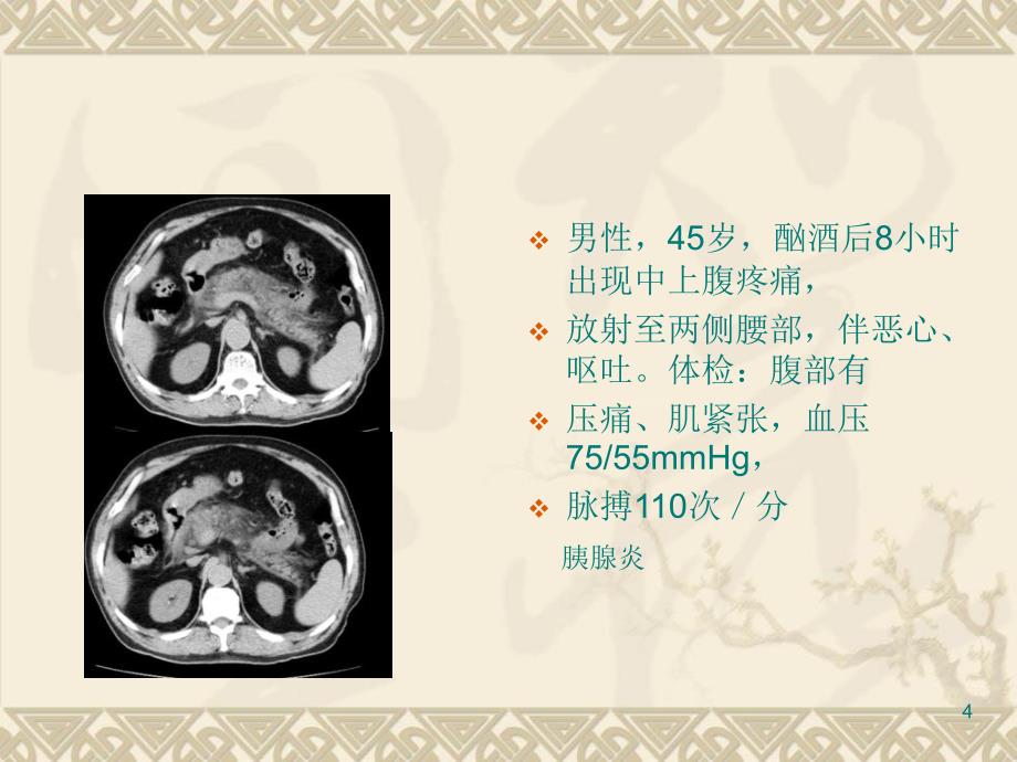 名师推荐影像典型图片PPT课件.ppt_第4页